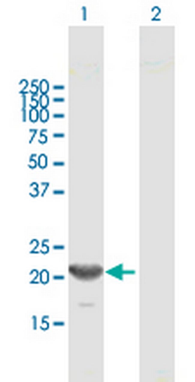 GINS1 Antibody in Western Blot (WB)