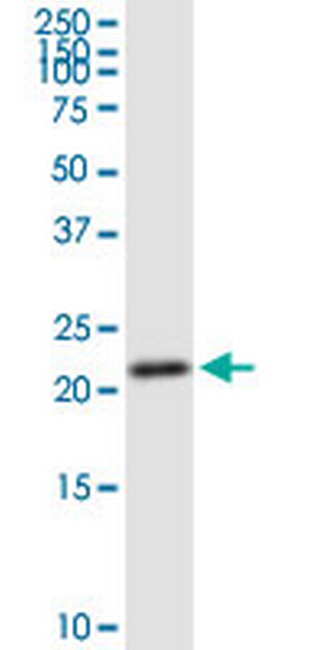 GINS1 Antibody in Western Blot (WB)