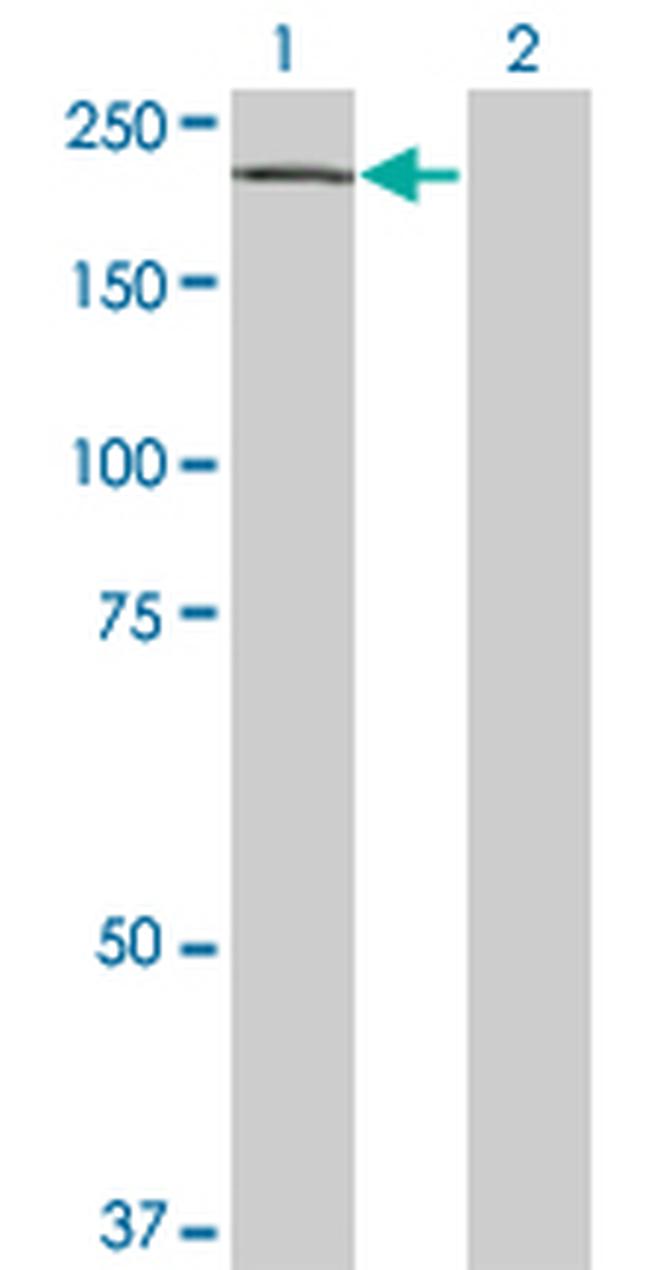 ZFHX1B Antibody in Western Blot (WB)