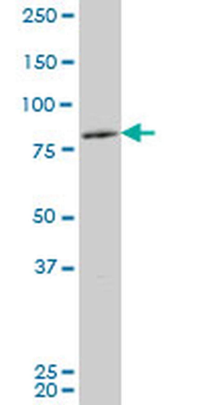 ZFHX1B Antibody in Western Blot (WB)