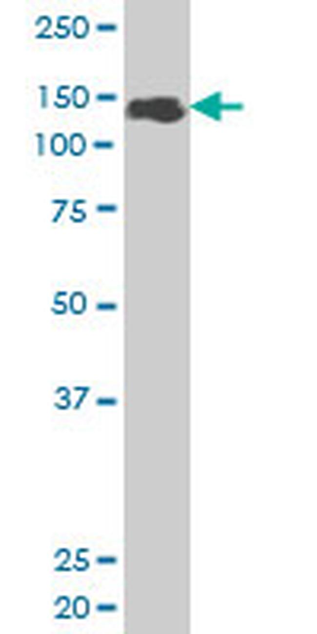 ZFHX1B Antibody in Western Blot (WB)