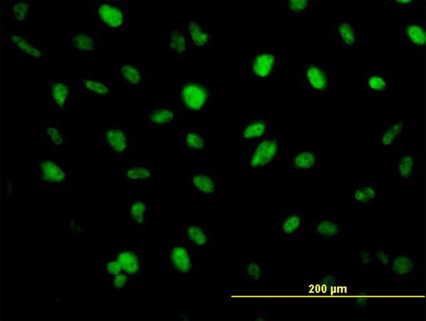 ZFHX1B Antibody in Immunocytochemistry (ICC/IF)