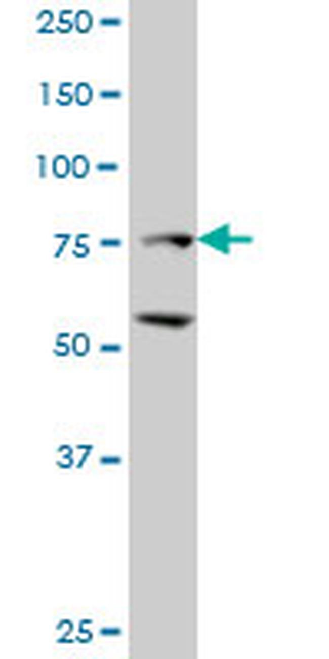 ZFHX1B Antibody in Western Blot (WB)