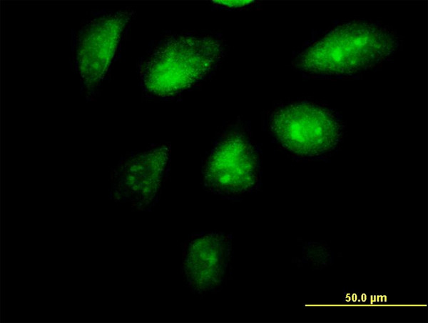 SETDB1 Antibody in Immunocytochemistry (ICC/IF)