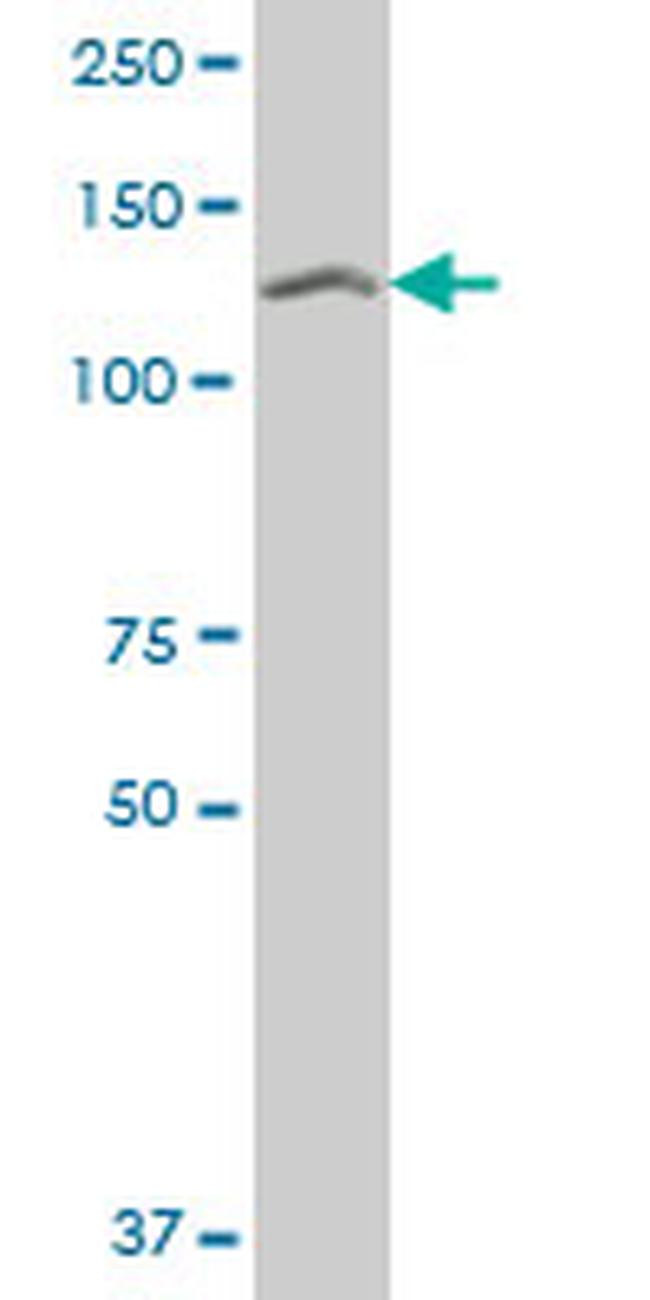 SETDB1 Antibody in Western Blot (WB)