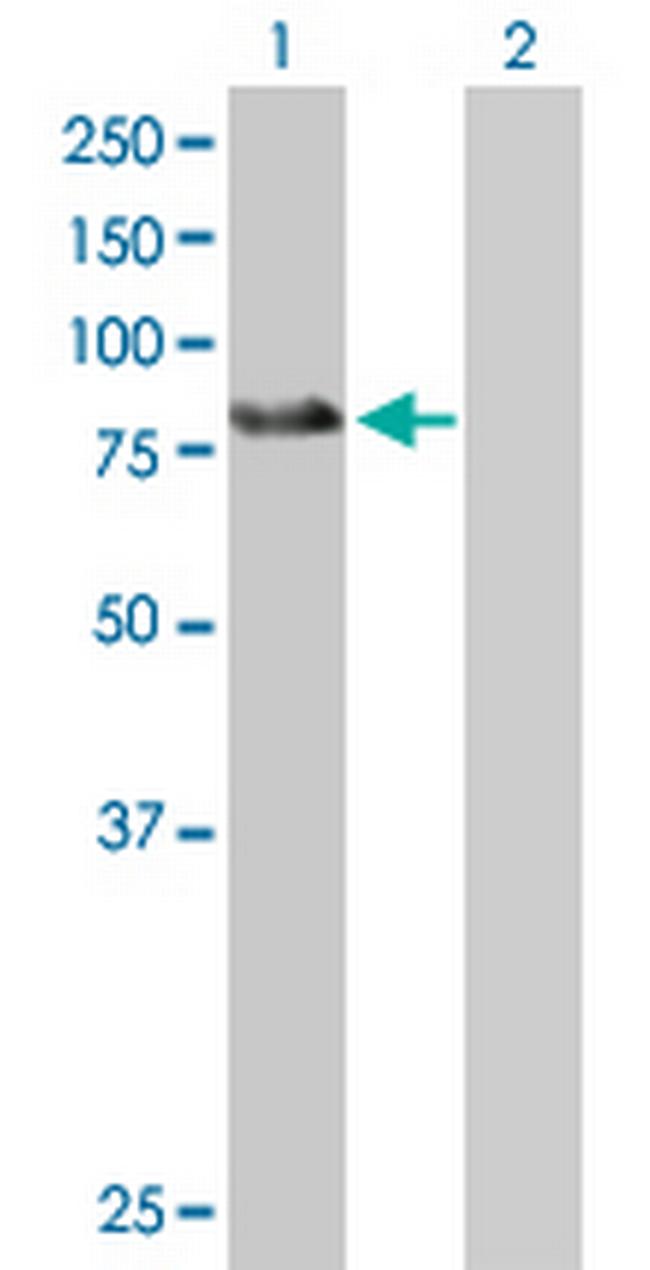 ZBTB39 Antibody in Western Blot (WB)