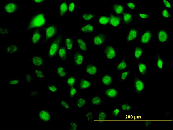 HELZ Antibody in Immunocytochemistry (ICC/IF)