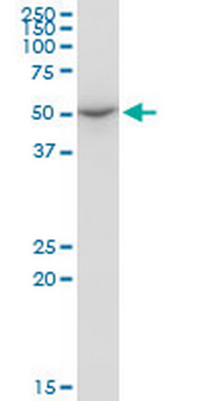 ENDOGL1 Antibody in Western Blot (WB)