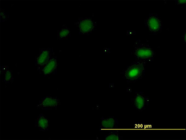 OXSR1 Antibody in Immunocytochemistry (ICC/IF)