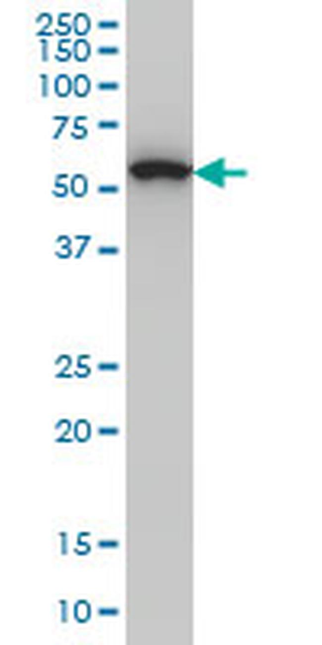 OXSR1 Antibody in Western Blot (WB)