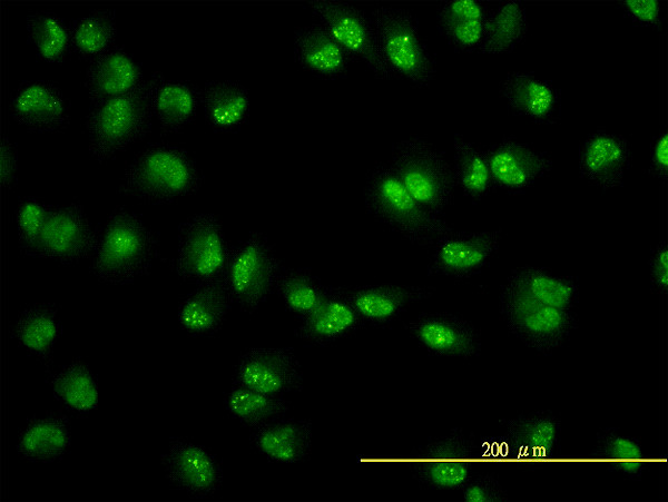 USP15 Antibody in Immunocytochemistry (ICC/IF)