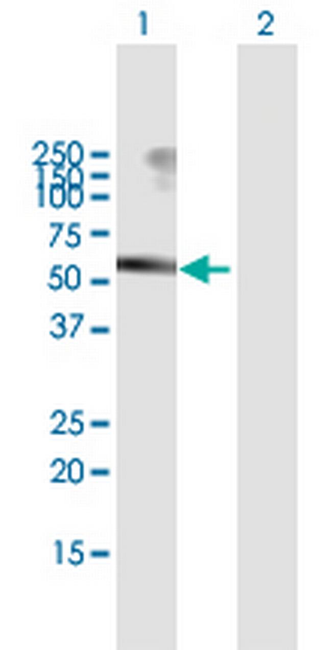 USP3 Antibody in Western Blot (WB)