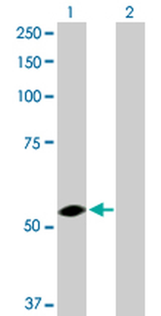 USP3 Antibody in Western Blot (WB)