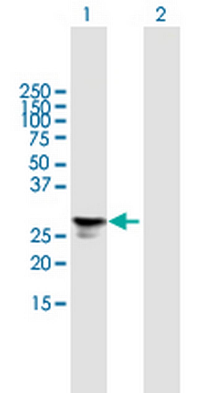 FGFBP1 Antibody in Western Blot (WB)