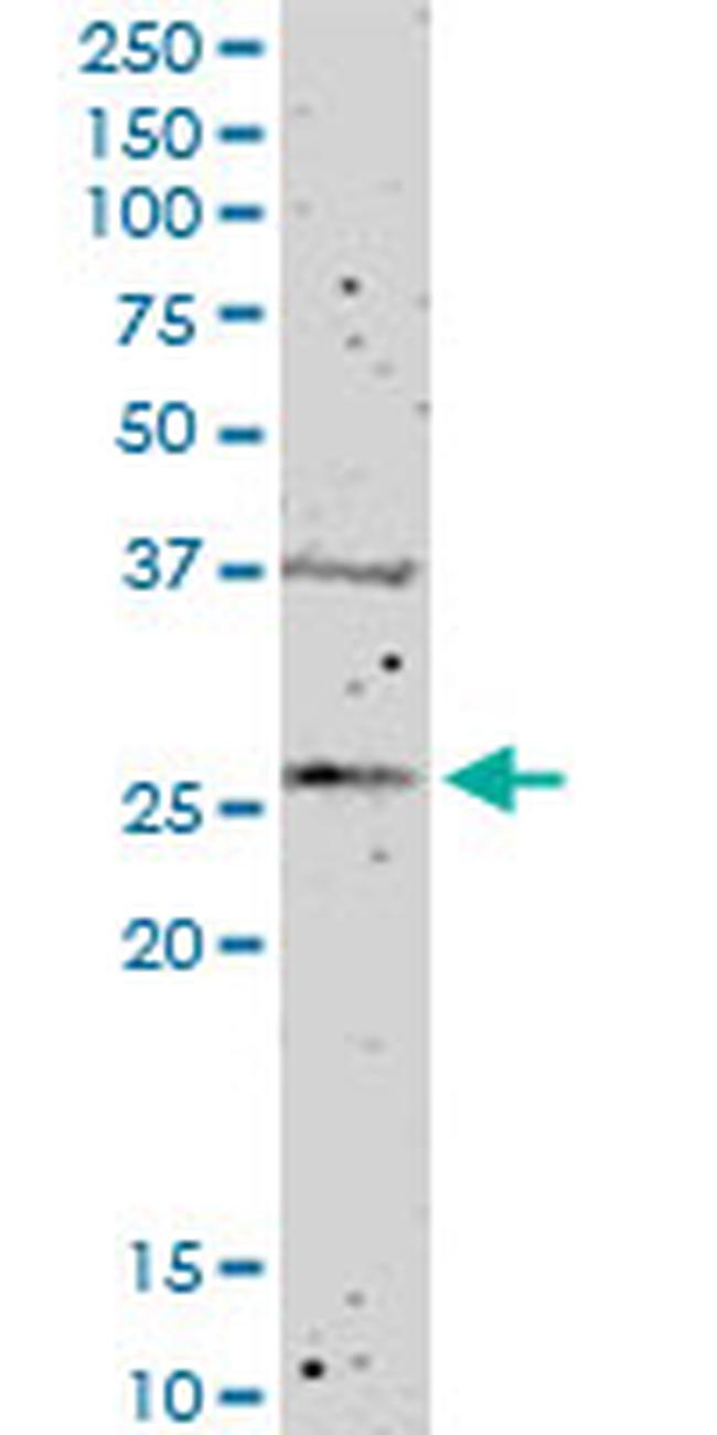 FGFBP1 Antibody in Western Blot (WB)