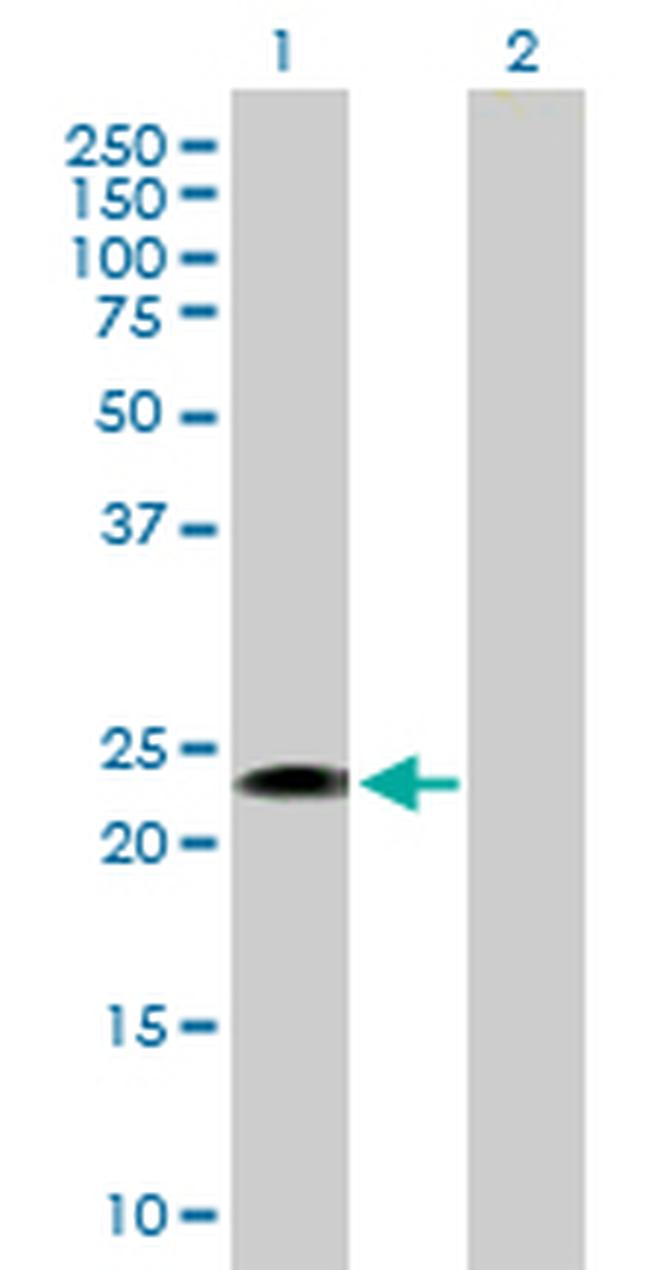 FGFBP1 Antibody in Western Blot (WB)