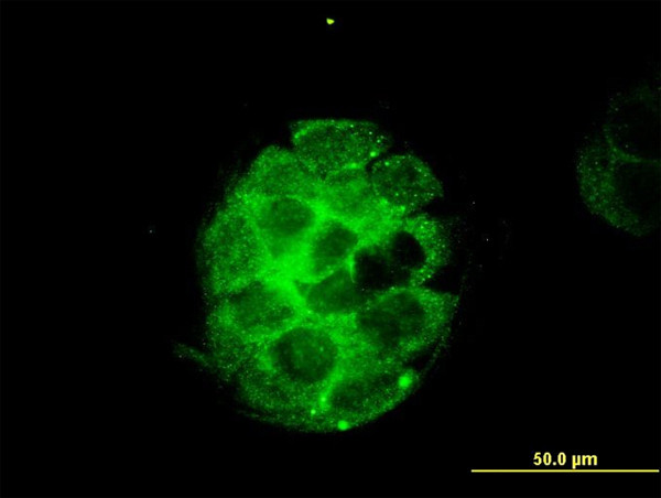 AKT3 Antibody in Immunocytochemistry (ICC/IF)