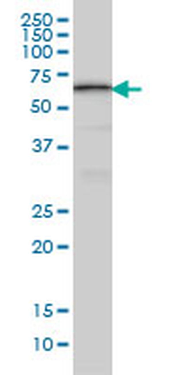 AKT3 Antibody in Western Blot (WB)