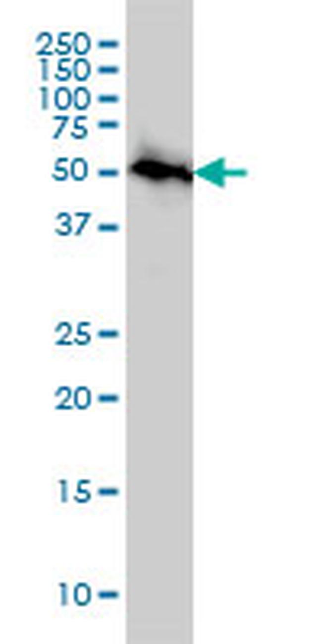 AKT3 Antibody in Western Blot (WB)