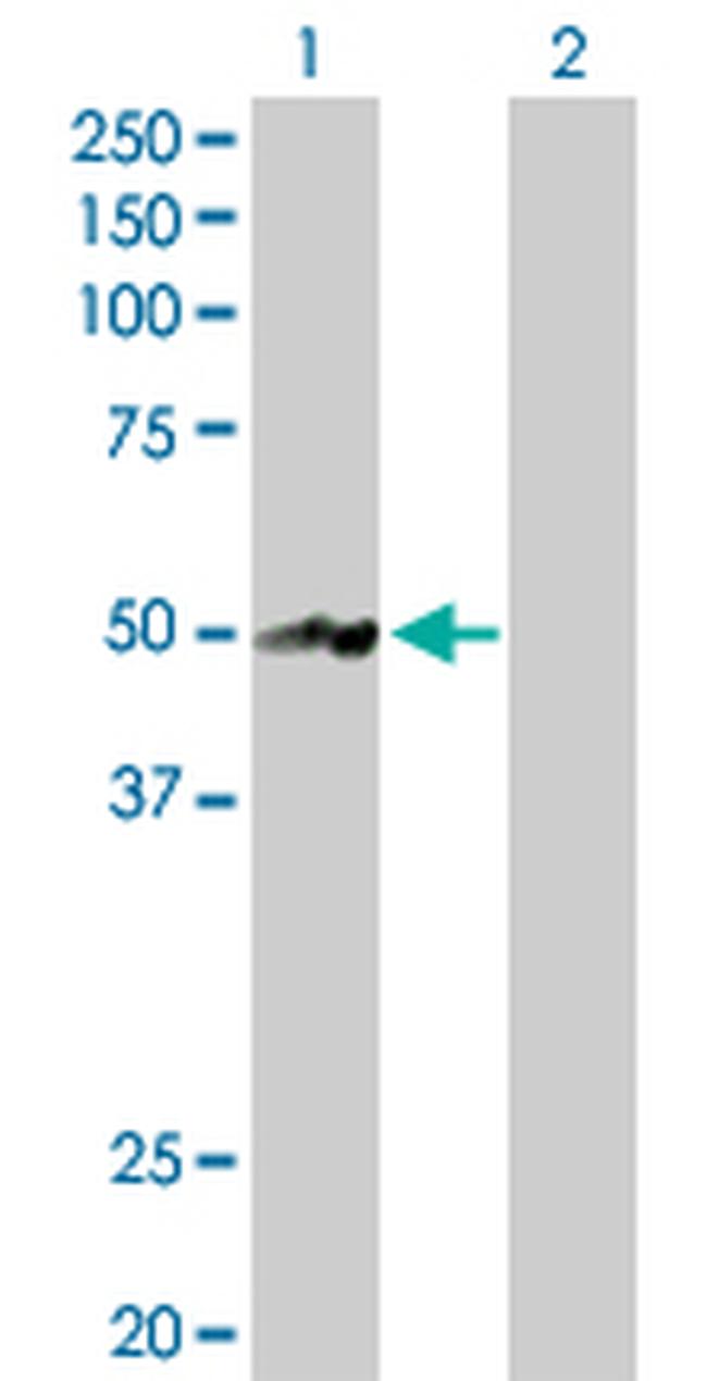 NR2E3 Antibody in Western Blot (WB)