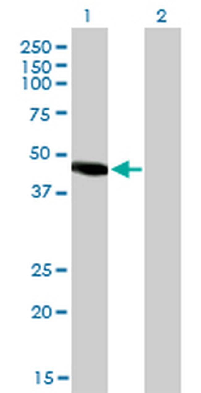 NR2E3 Antibody in Western Blot (WB)