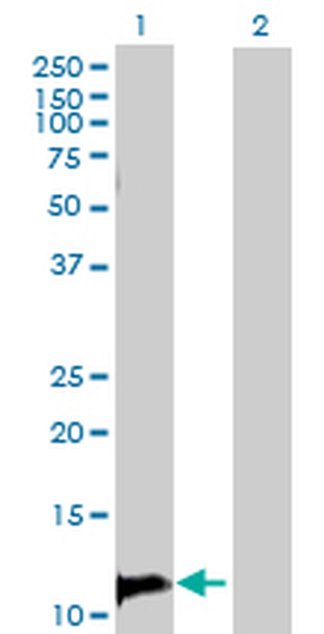 TANK Antibody in Western Blot (WB)