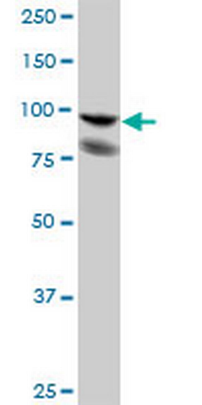 PDCD6IP Antibody in Western Blot (WB)