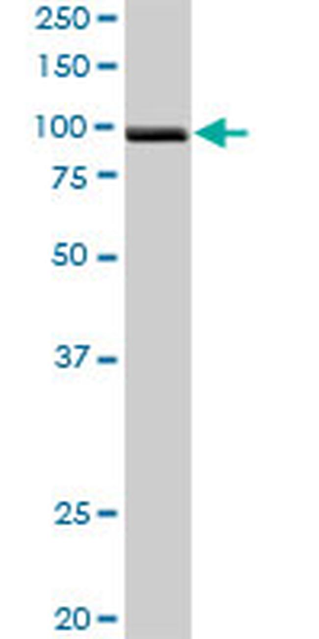 PDCD6IP Antibody in Western Blot (WB)