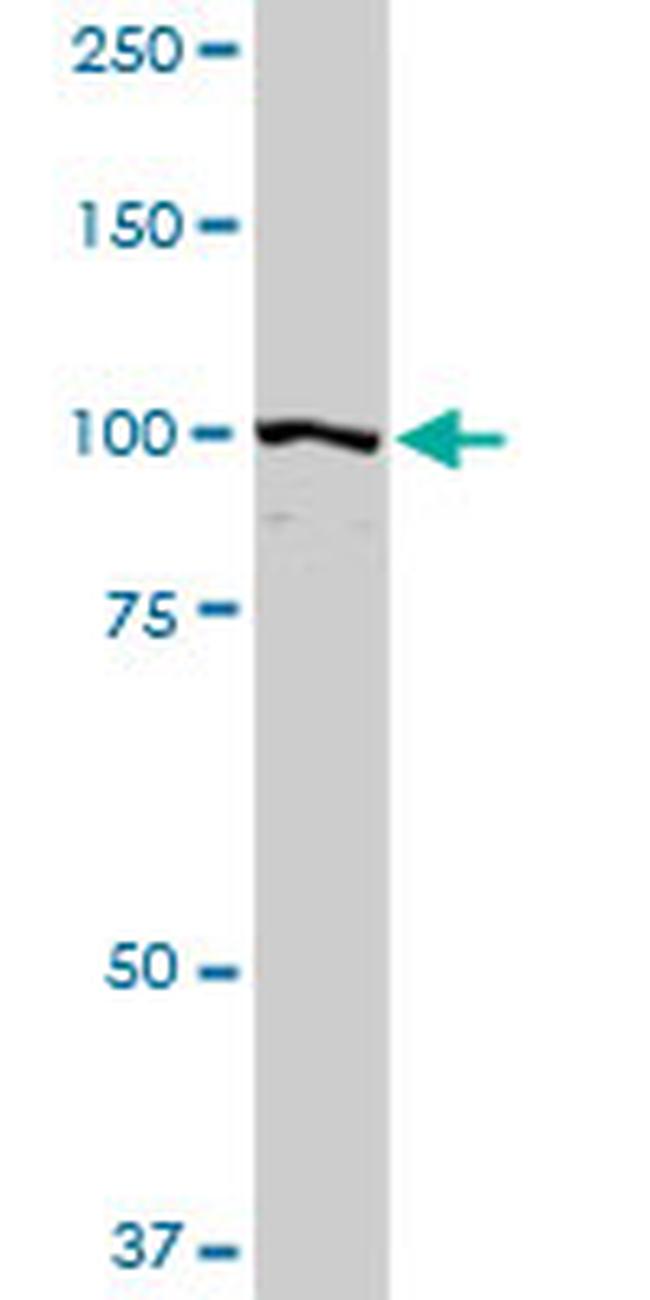 PDCD6IP Antibody in Western Blot (WB)