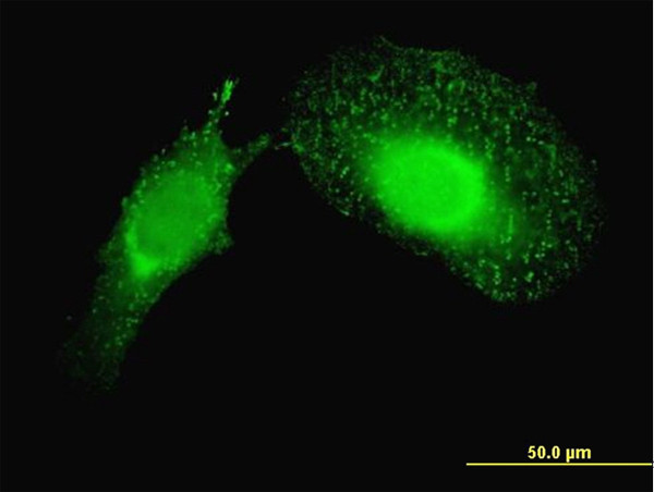 PDCD6IP Antibody in Immunocytochemistry (ICC/IF)