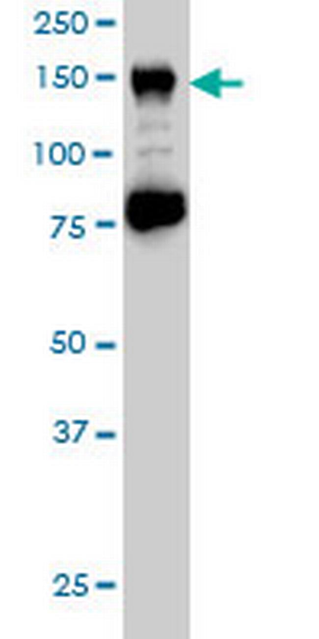 CHAF1A Antibody in Western Blot (WB)