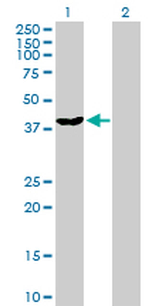 DNAJB6 Antibody in Western Blot (WB)