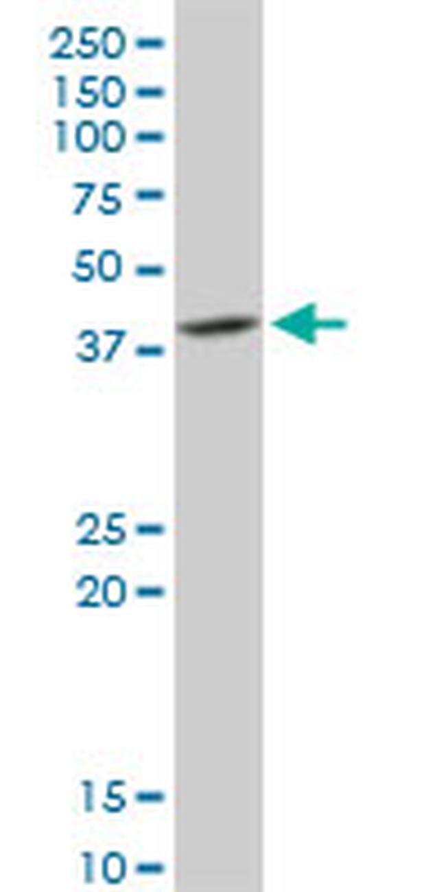 DNAJB6 Antibody in Western Blot (WB)