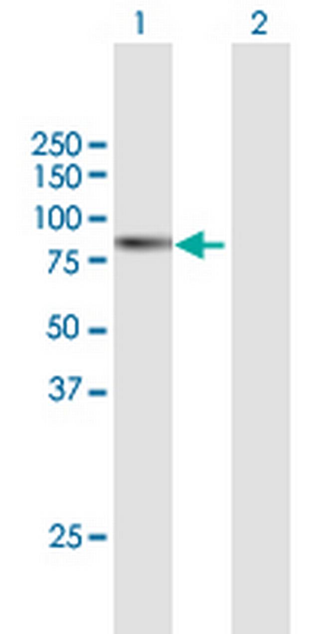 ABCF2 Antibody in Western Blot (WB)