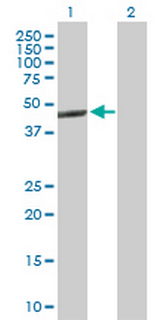 NR1H3 Antibody in Western Blot (WB)