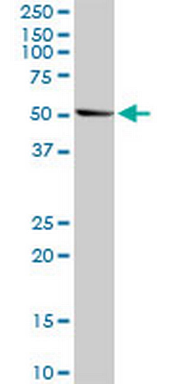 NR1H3 Antibody in Western Blot (WB)