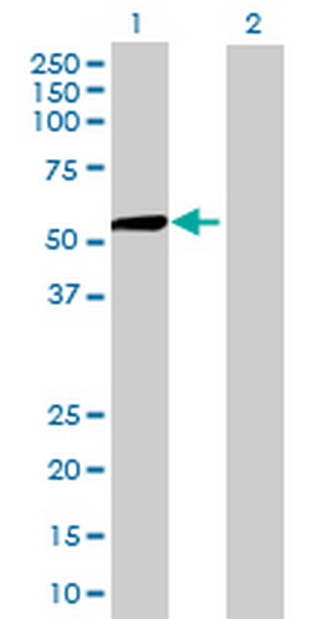 RNUT1 Antibody in Western Blot (WB)