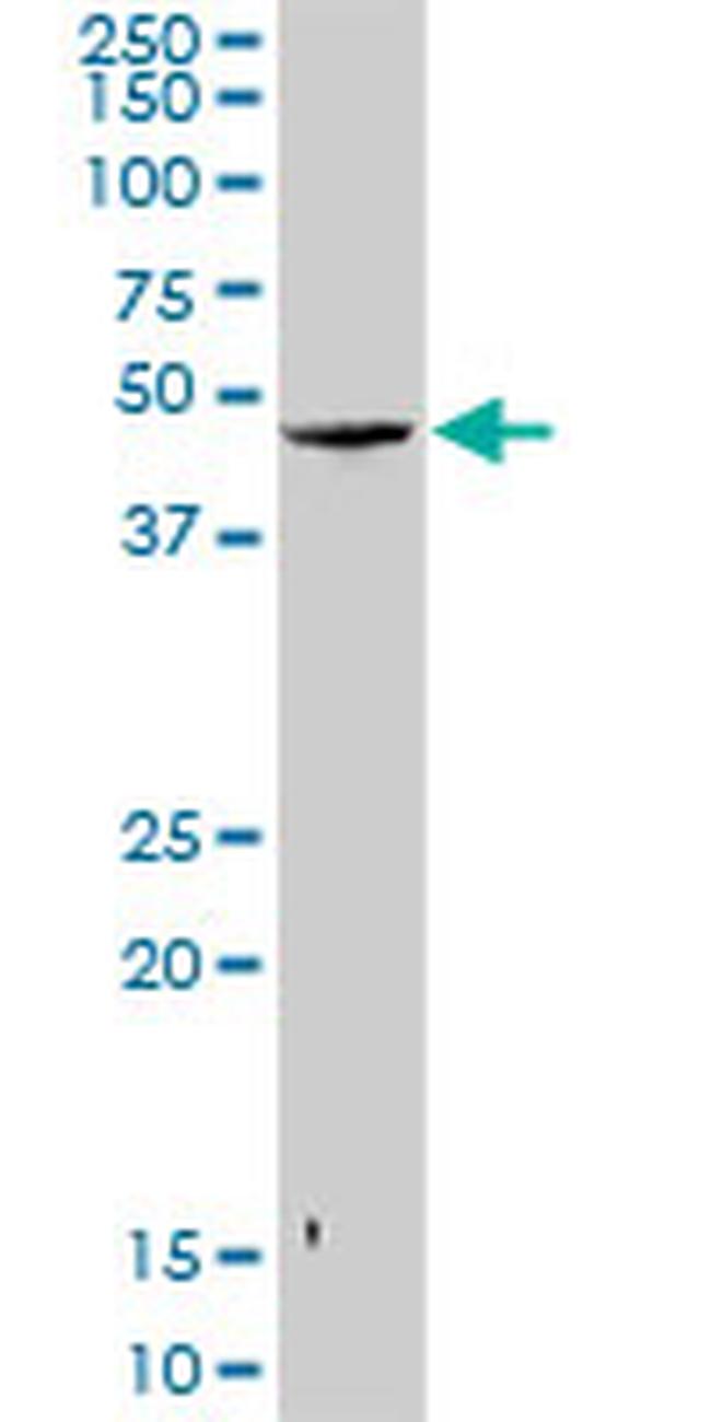 SNUPN Antibody in Western Blot (WB)