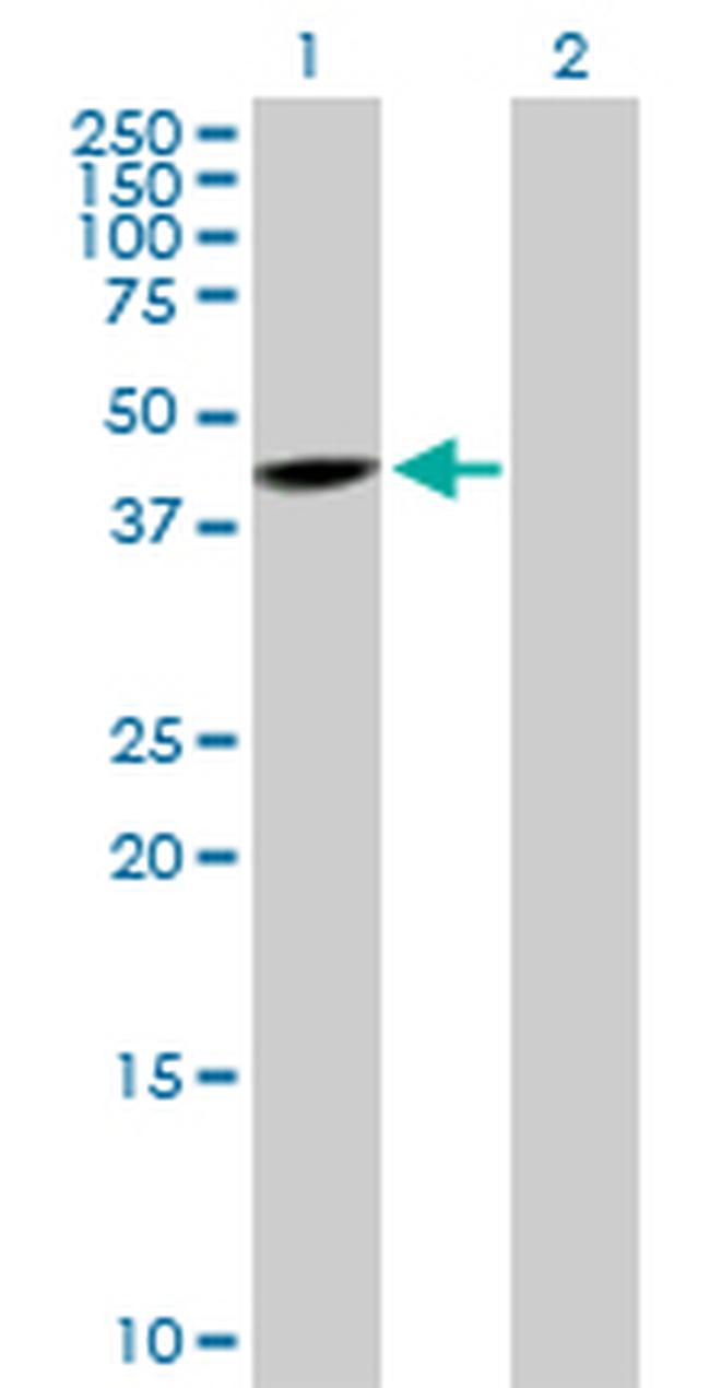 SNUPN Antibody in Western Blot (WB)