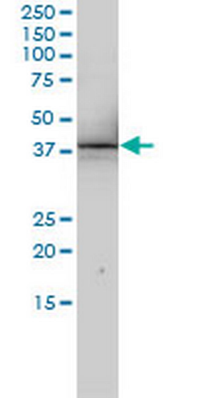 RNUT1 Antibody in Western Blot (WB)