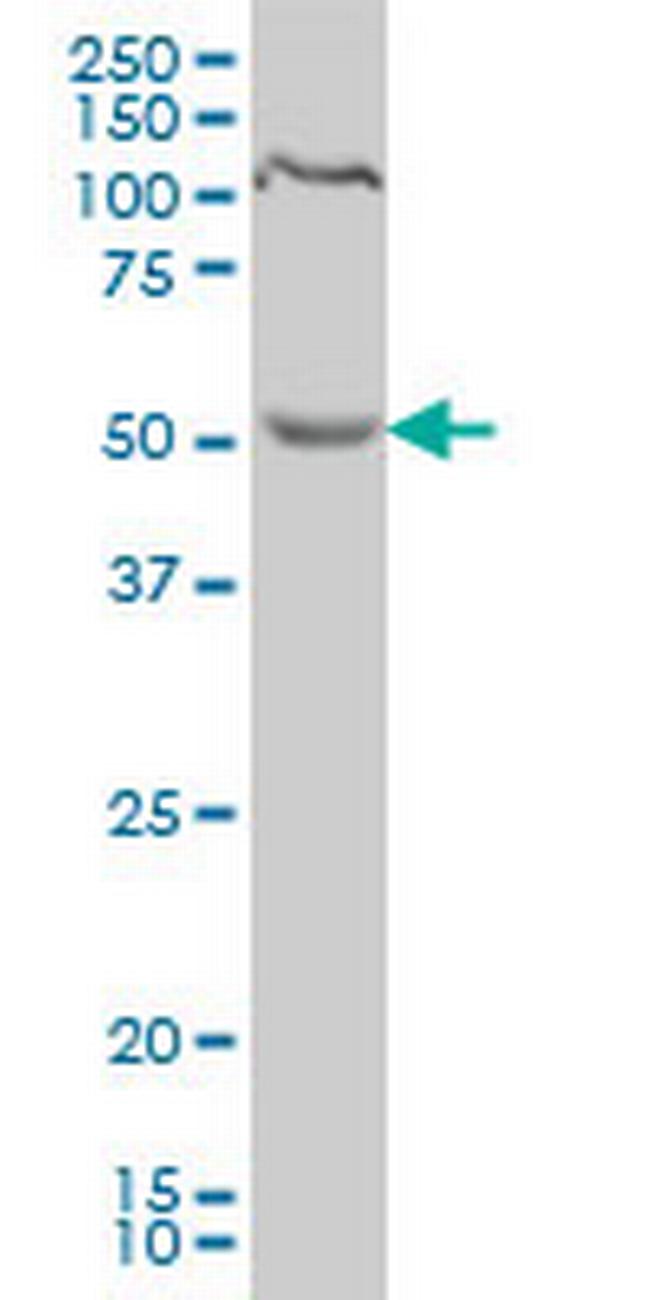 PDCD7 Antibody in Western Blot (WB)