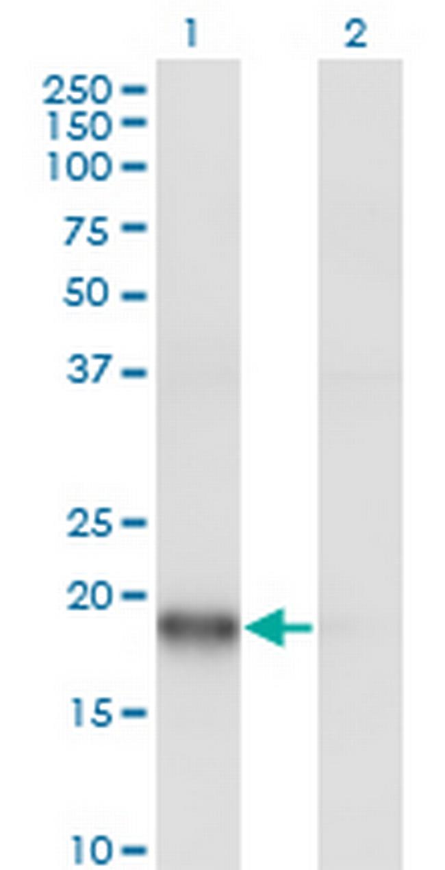 ARPC3 Antibody in Western Blot (WB)