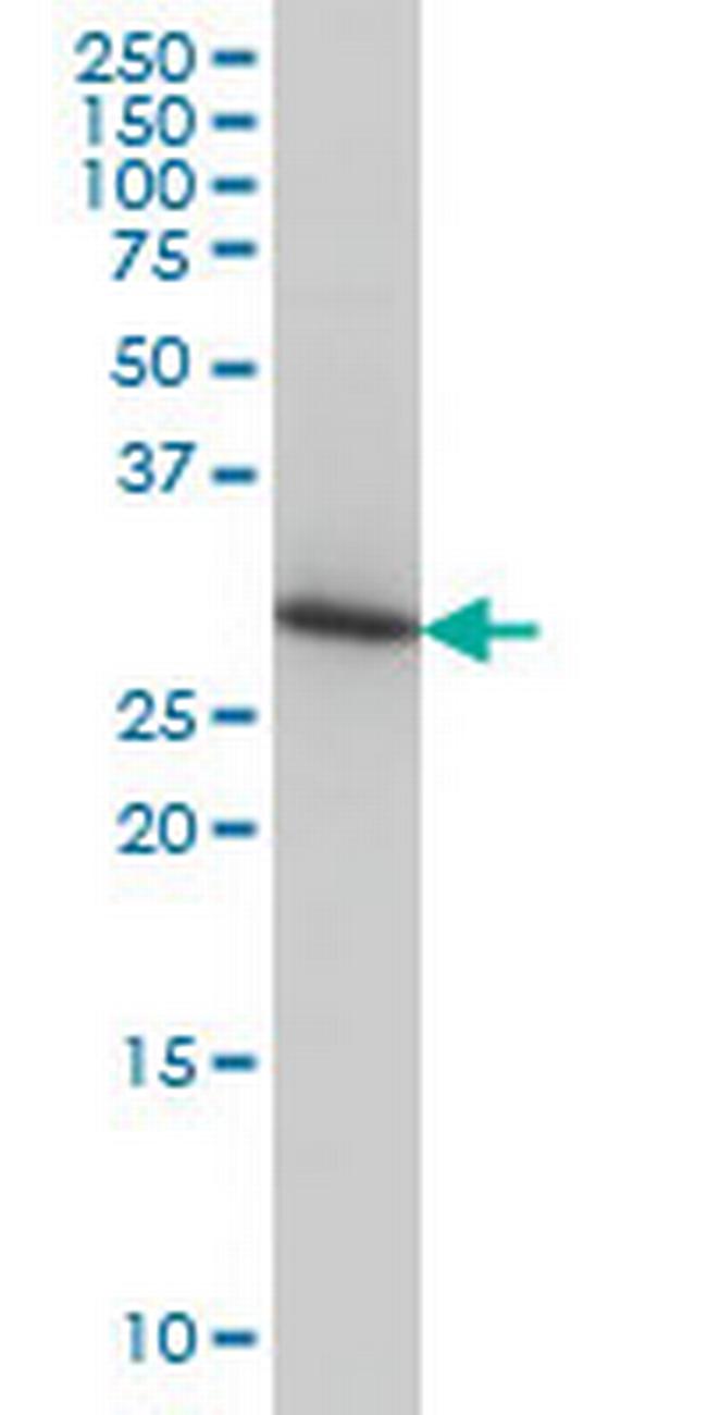 ARPC2 Antibody in Western Blot (WB)