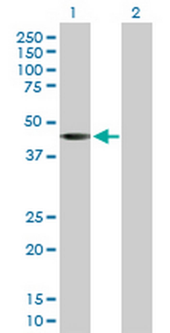 SGK2 Antibody in Western Blot (WB)