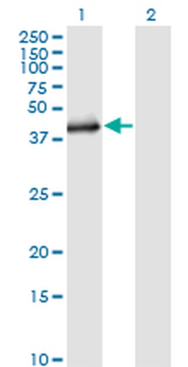 SGK2 Antibody in Western Blot (WB)