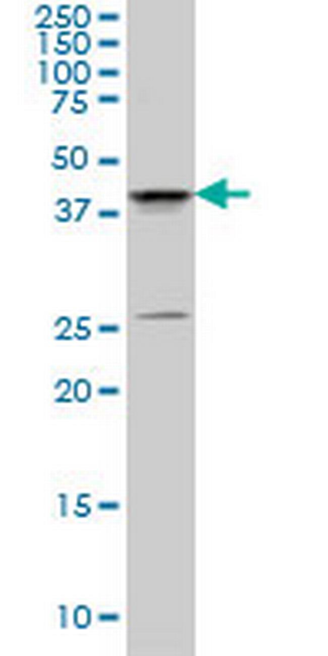 SGK2 Antibody in Western Blot (WB)