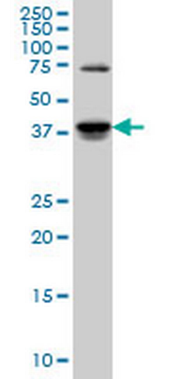 SGK2 Antibody in Western Blot (WB)