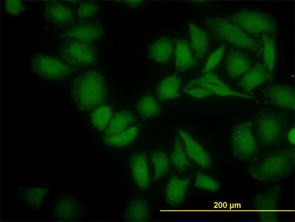 SGK2 Antibody in Immunocytochemistry (ICC/IF)