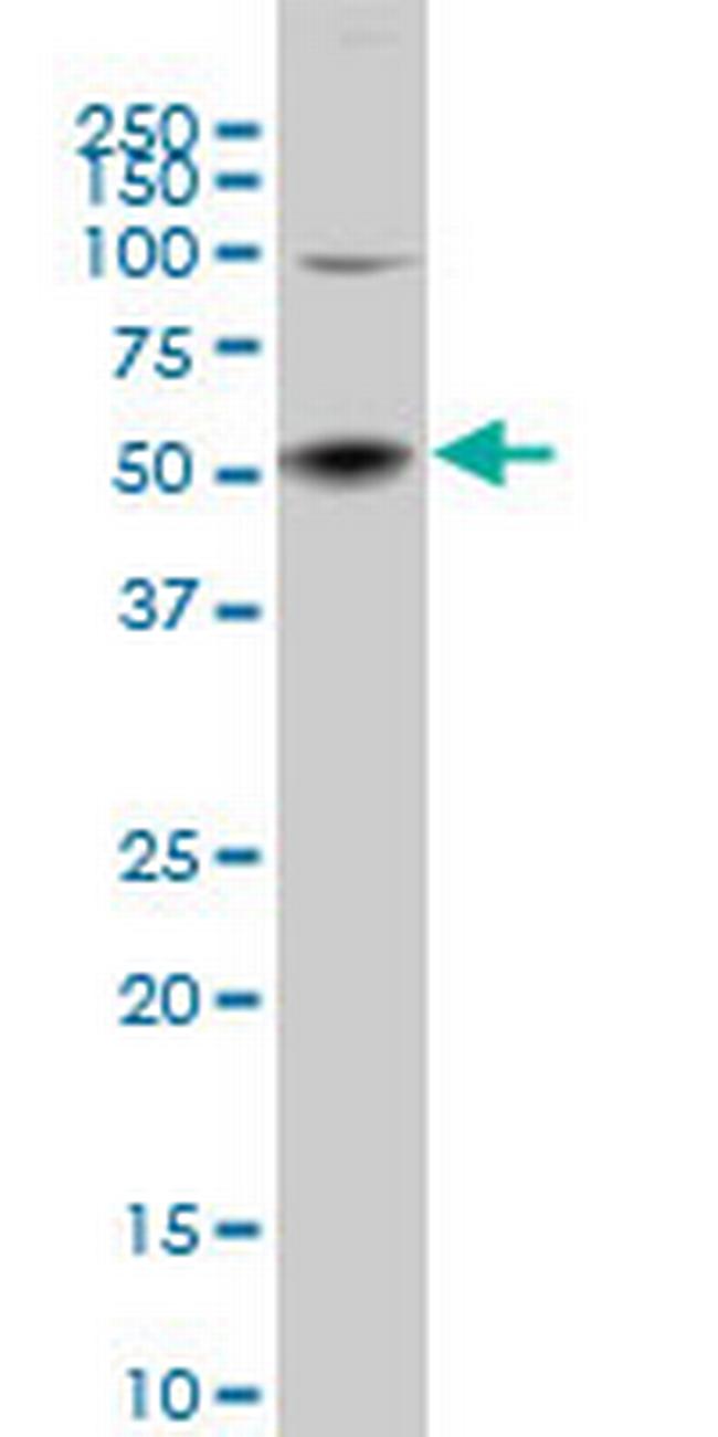 SGK2 Antibody in Western Blot (WB)