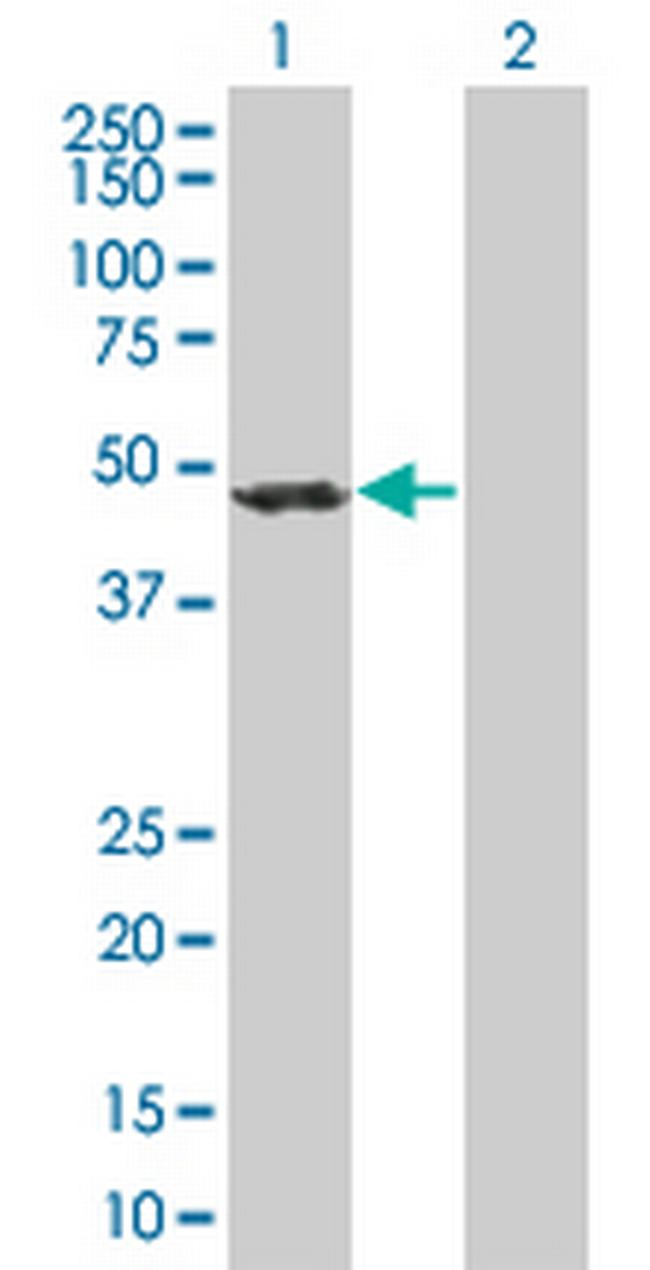 ACTR1B Antibody in Western Blot (WB)